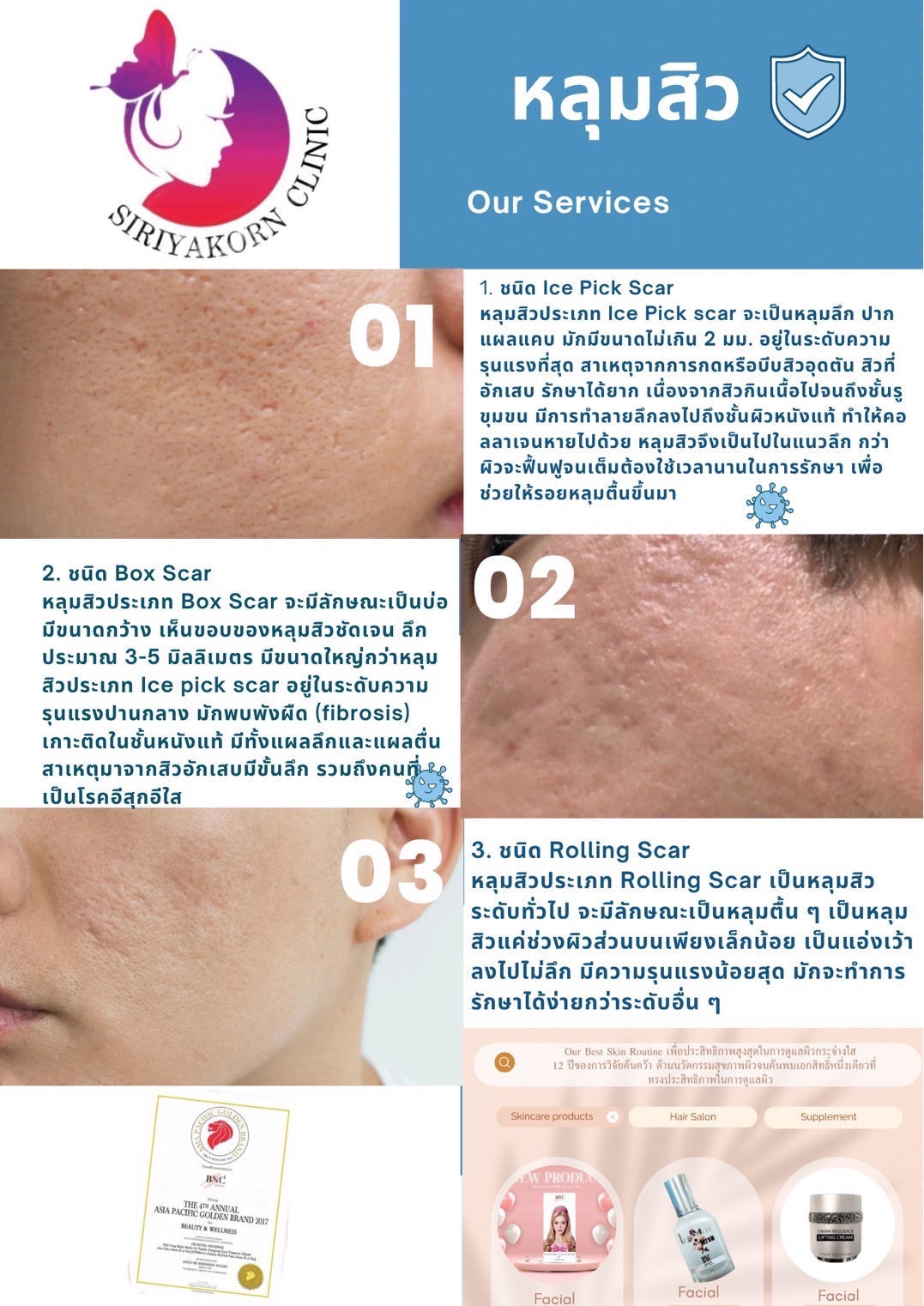 สิวมีกีชนิด รักษาด้วยวิธีใดได้บ้าง? What Types Of Acne Can Be Treated?